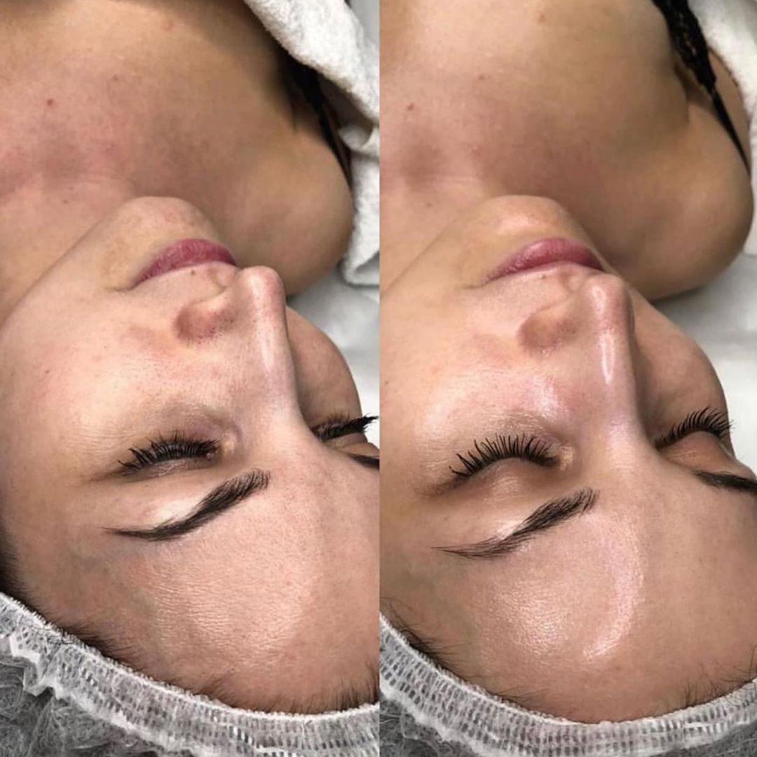 Уход "Огонь и Лед" IS Clinical - Фото №1 Уход "Огонь и Лед" IS Clinical - Фото №1